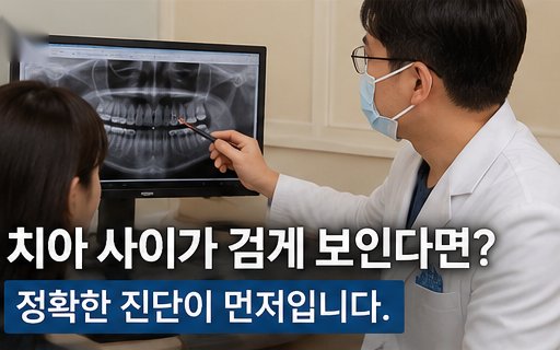 치아 사이 검은 점 정확한 진단