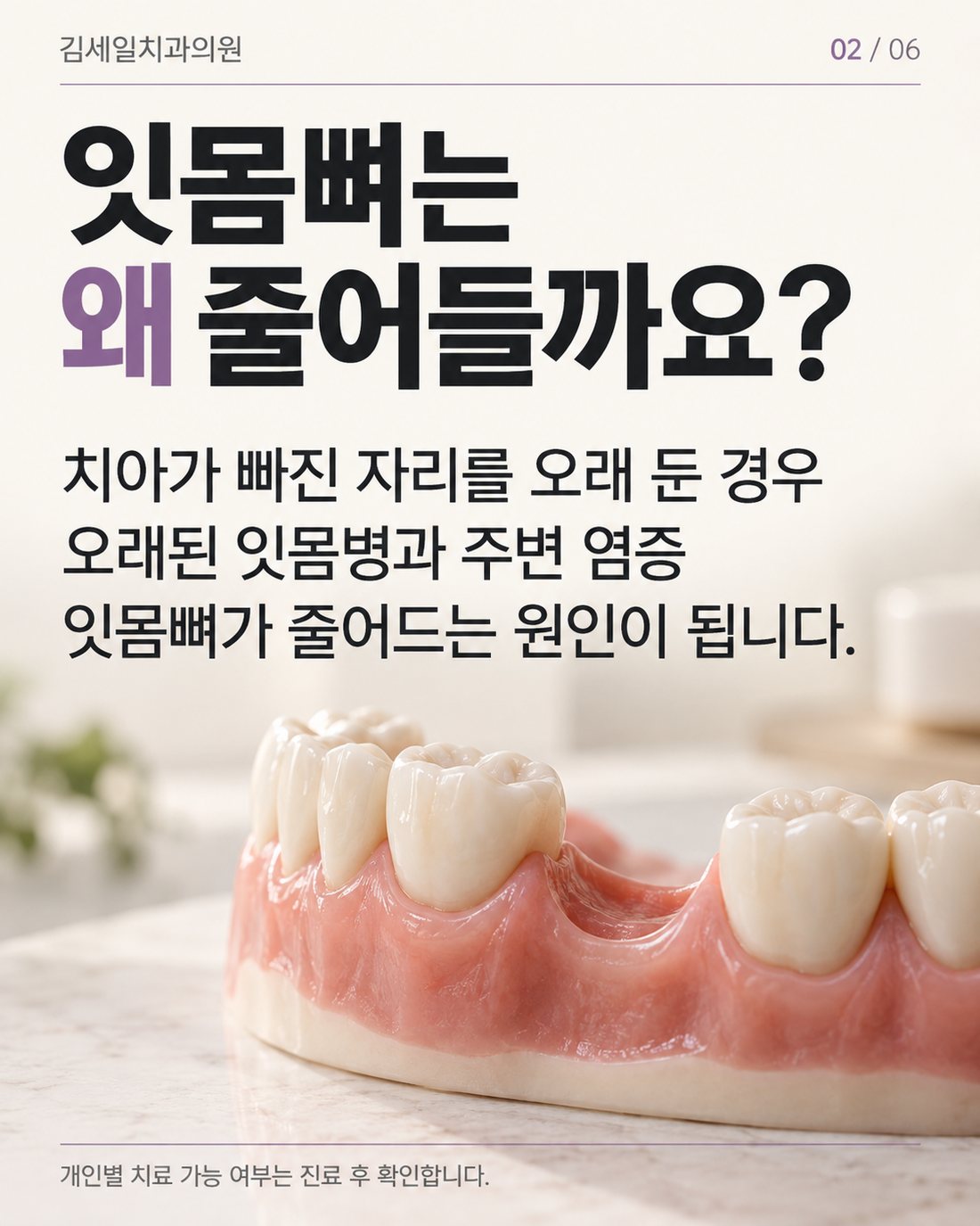 잇몸뼈가 줄어드는 원인 카드뉴스