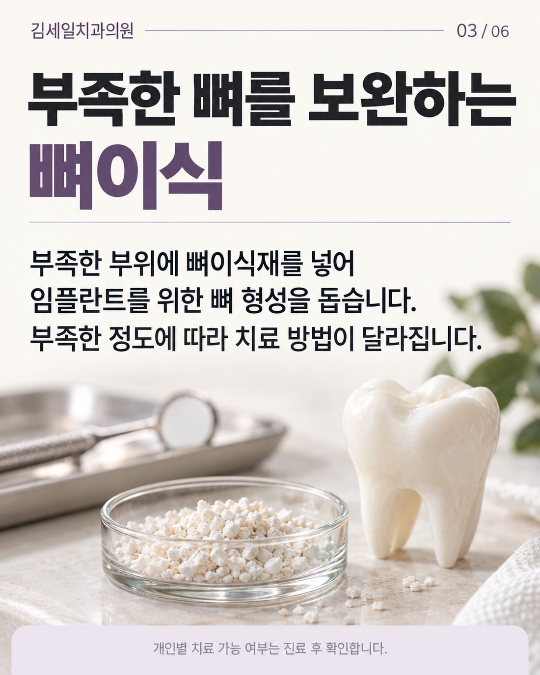 뼈이식 개념 카드뉴스