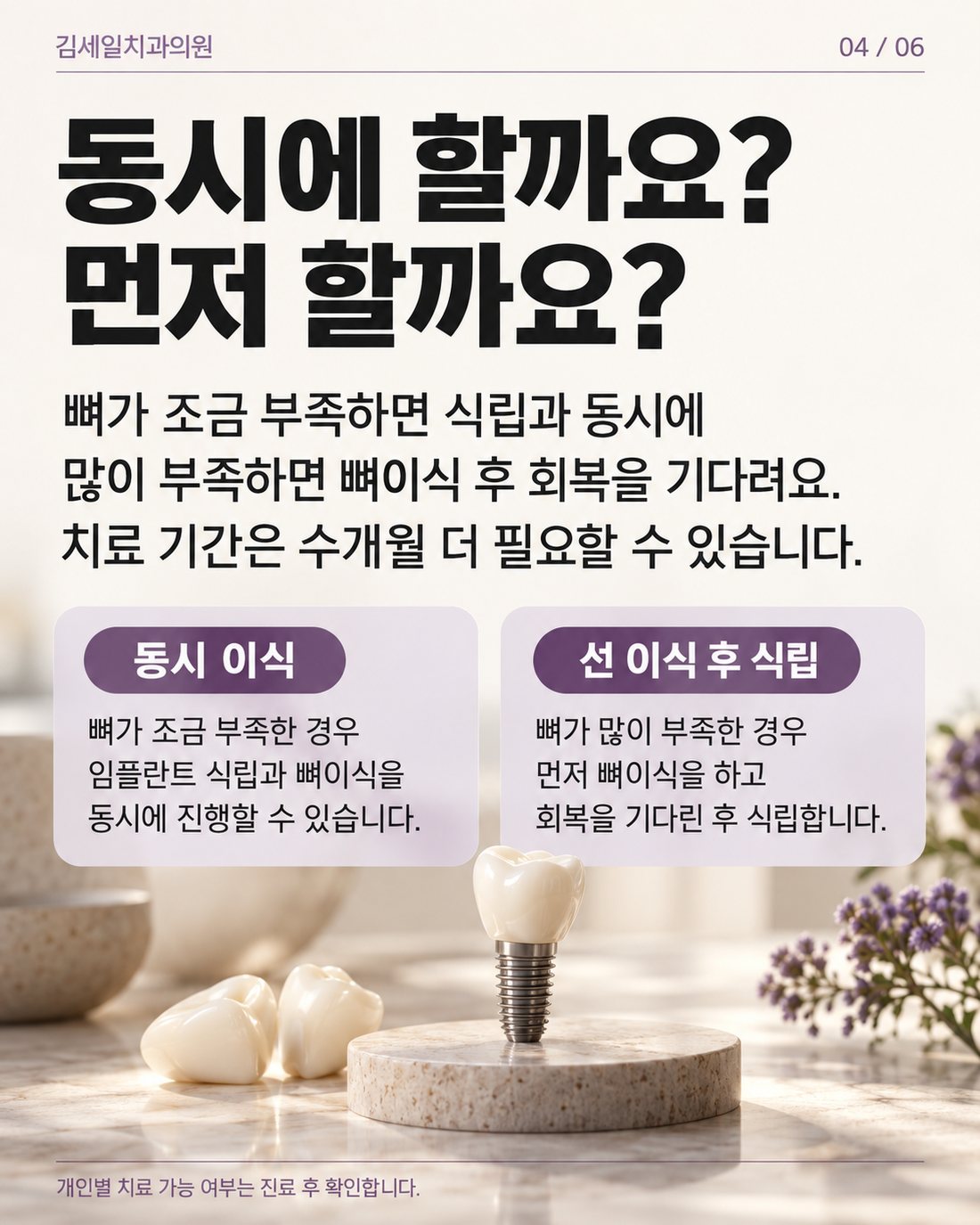 동시 이식과 선 이식 후 식립 비교 카드뉴스