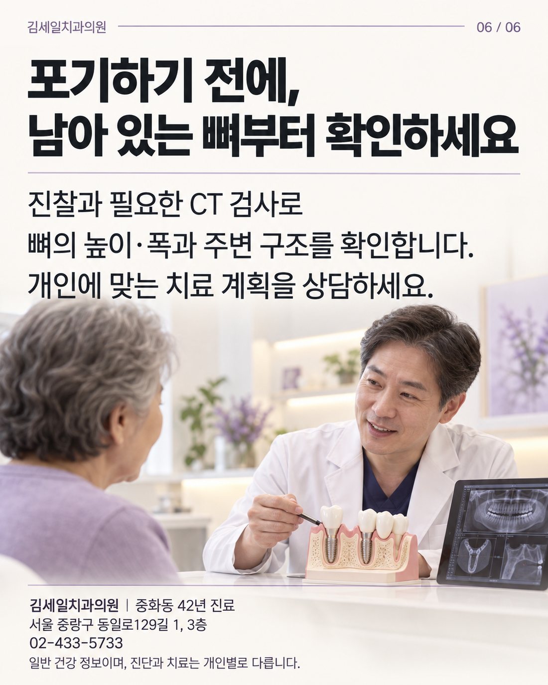 CT로 잇몸뼈 상태 확인 카드뉴스